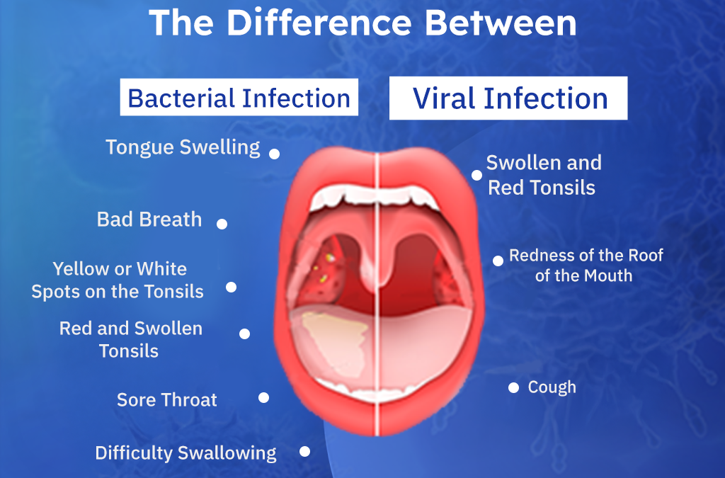 Viral vs Bacterial Infections