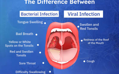 Viral vs Bacterial Infections